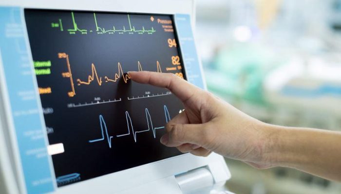 IA doenças cardiácas