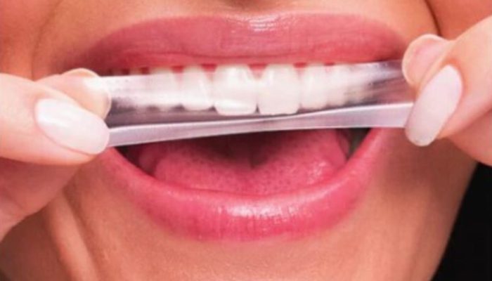 anvisa-proibe-esmalte-e-fita-dental-1