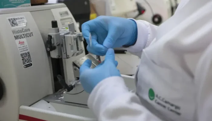 SUS incorpora nova terapia para tratamento de leucemia mieloide em adultos